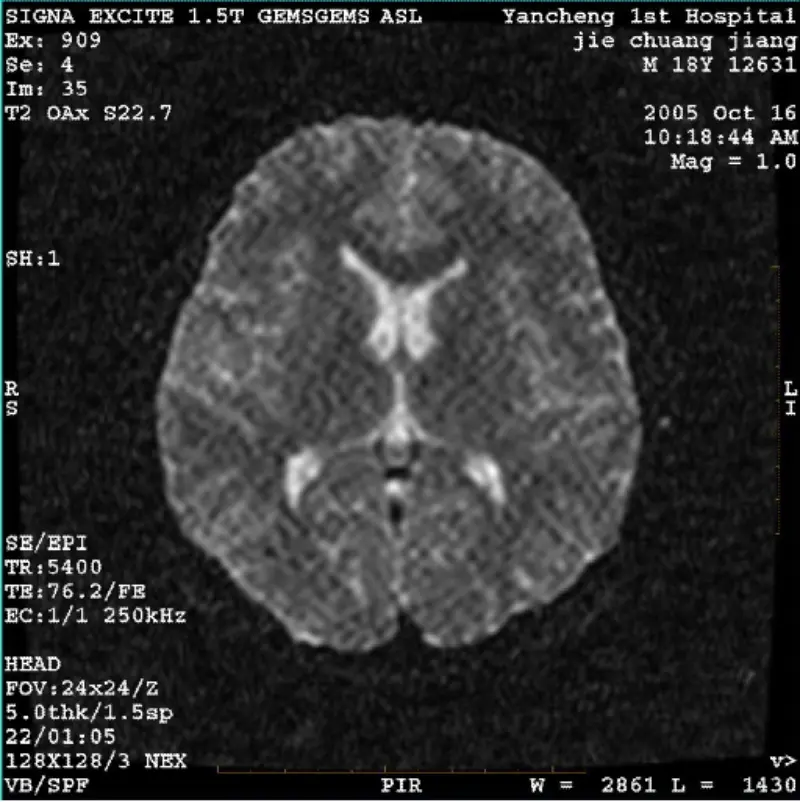 ARTIFACT WI/Fiesta Image Alba Pixel